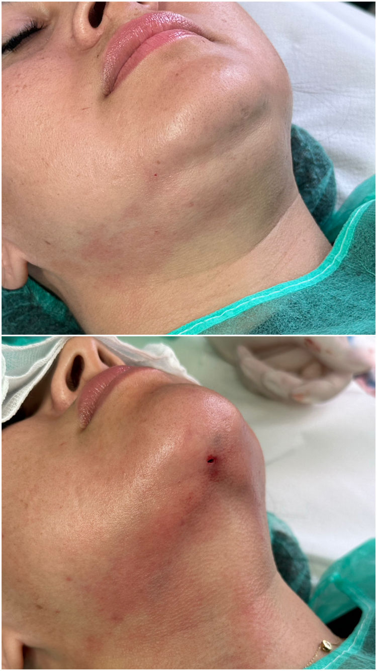 cirugia-3-clinicas-belice