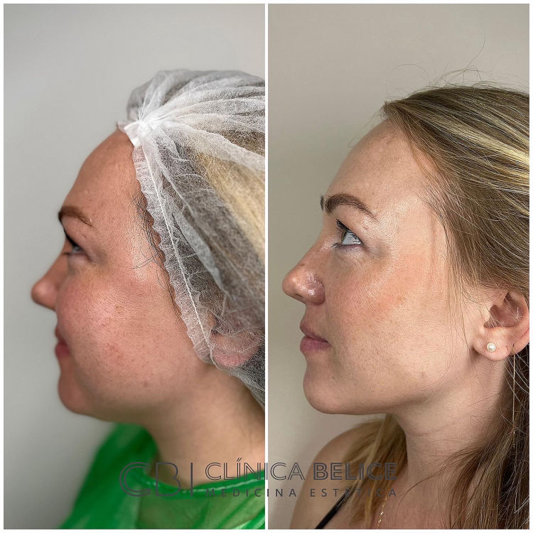 cirugia-5-clinicas-belice